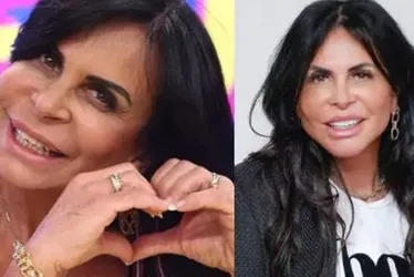 Imagem ilustrativa da imagem Especialistas explicam limites da harmonização