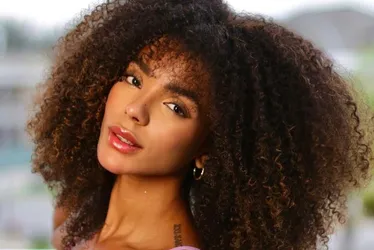 Imagem ilustrativa da imagem Esposa de Ludmilla faz nova harmonização facial e mostra mudanças