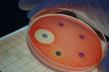 Imagem ilustrativa da imagem Estudo descobre nova geração de superbactérias