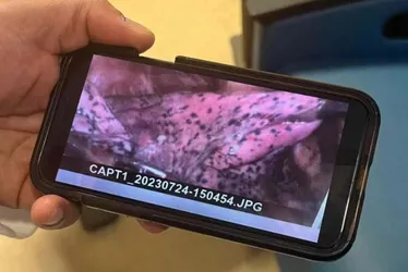Imagem ilustrativa da imagem FOTO | Lutador de 20 anos posta foto do pulmão após uso de vape