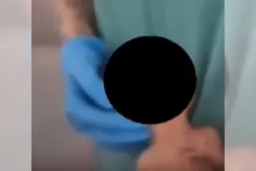 Imagem ilustrativa da imagem Fisioterapeuta que fez "dancinha" com bebê no bolso do jaleco é investigada