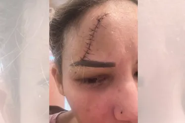 Imagem ilustrativa da imagem Foto mostra que médica já foi agredida por marido, afirma família