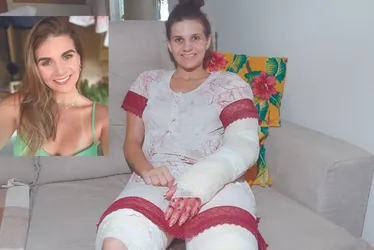 Imagem ilustrativa da imagem Influencer que teve o corpo queimado deixa hospital: “Deus que me deu forças”