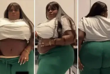 Imagem ilustrativa da imagem Jojo Todynho mostra como ficou sua barriga após cirurgia bariátrica