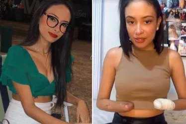 Imagem ilustrativa da imagem Jovem é internada com infecção urinária e tem pés e mãos amputados