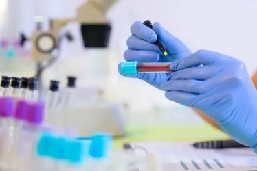 Imagem ilustrativa da imagem Pacientes buscam teste genético para identificar predisposição ao câncer