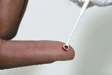 Imagem ilustrativa da imagem PrEP: tratamento preventivo é alternativa no combate ao HIV no Brasil