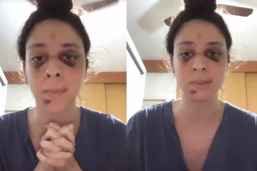 Imagem ilustrativa da imagem Victor Meyniel agradece apoio em vídeo após ter sofrido agressão