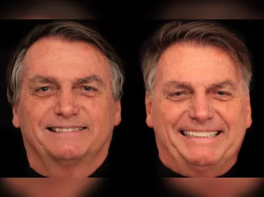 Imagem ilustrativa da imagem Bolsonaro põe lentes nos dentes e diz que vaidade não faz mal