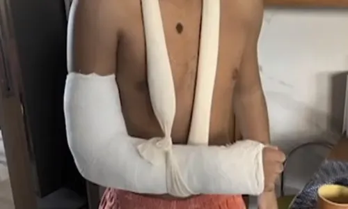 
          Imagem ilustrativa da imagem Adolescente quebra o pulso após encostar em corrimão de ponte e levar choque
          