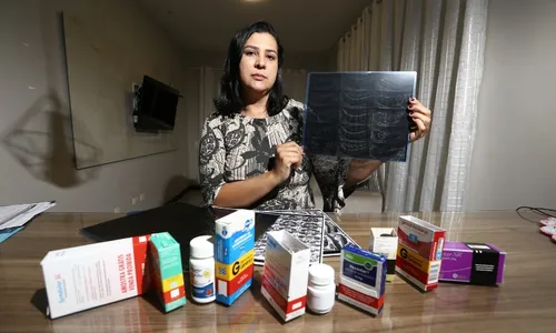 
          Imagem ilustrativa da imagem “Adquiri várias sequelas pelo uso indiscriminado de remédios”, diz vendedora
          