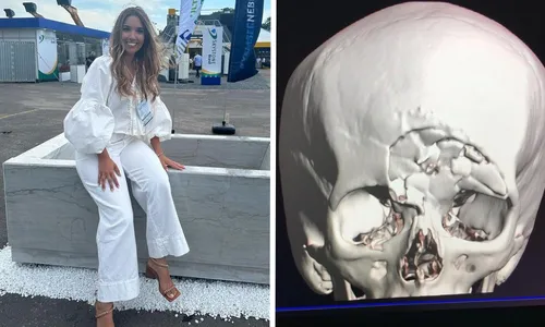 
          Imagem ilustrativa da imagem Advogada ferida com pedra vai passar por nova cirurgia
          