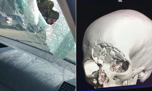 
          Imagem ilustrativa da imagem Advogada fratura a cabeça após levar pedrada dentro de carro na Rodovia do Sol
          