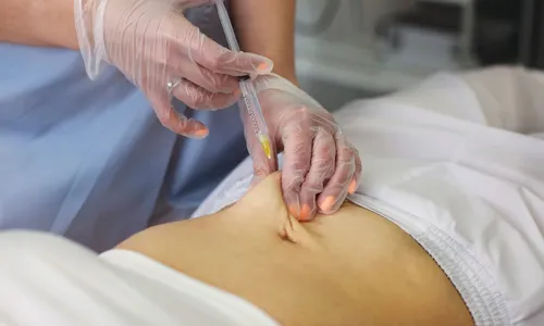 
          Imagem ilustrativa da imagem Anvisa autoriza nova injeção para controle de colesterol
          