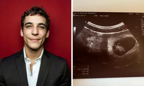 
          Imagem ilustrativa da imagem Ator de 'La Casa de Papel' e 'Elite' anuncia que será pai
          