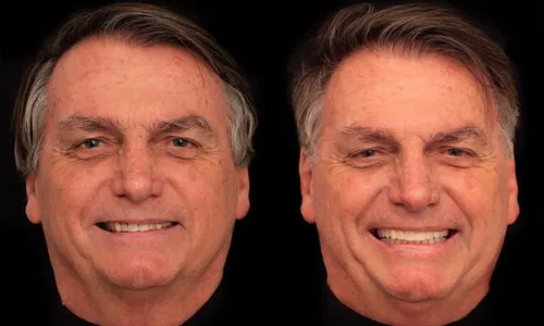 
          Imagem ilustrativa da imagem Bolsonaro põe lentes nos dentes e diz que vaidade não faz mal
          