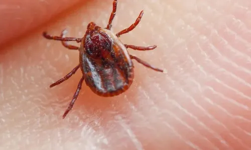 
          Imagem ilustrativa da imagem ES confirma quarta morte por febre maculosa neste ano
          