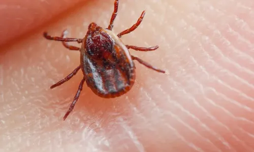 
          Imagem ilustrativa da imagem ES registra mais uma morte por febre maculosa
          