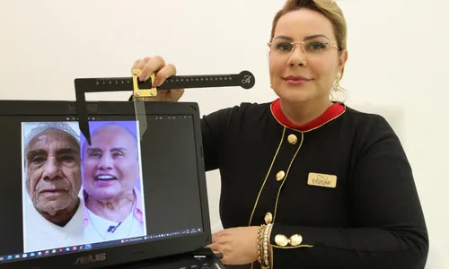 
          Imagem ilustrativa da imagem Especialistas explicam limites da harmonização
          