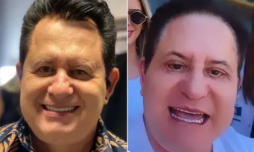 
          Imagem ilustrativa da imagem Especialistas explicam limites da harmonização
          