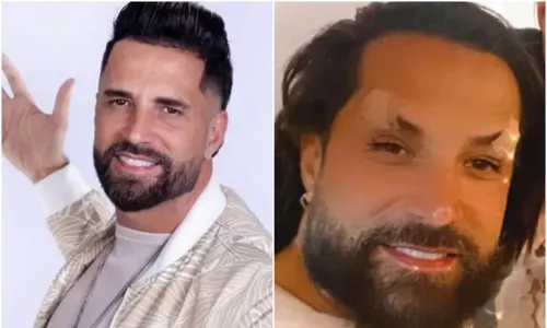 
          Imagem ilustrativa da imagem Especialistas explicam limites da harmonização
          