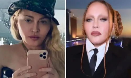 
          Imagem ilustrativa da imagem Especialistas explicam limites da harmonização
          