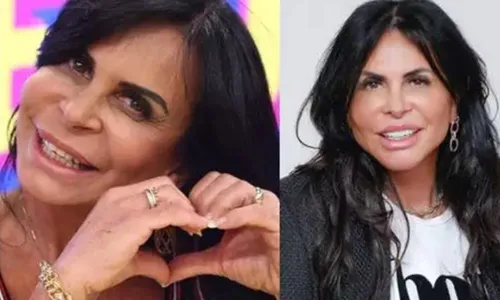 
          Imagem ilustrativa da imagem Especialistas explicam limites da harmonização
          