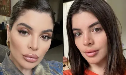 
          Imagem ilustrativa da imagem Especialistas explicam limites da harmonização
          