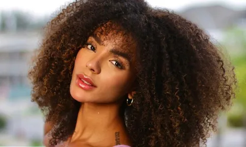 
          Imagem ilustrativa da imagem Esposa de Ludmilla faz nova harmonização facial e mostra mudanças
          