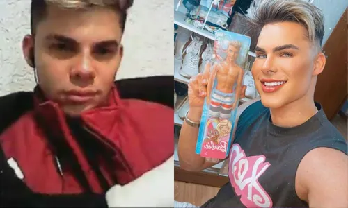 
          Imagem ilustrativa da imagem Ex-vendedor de hot dog gasta R$ 500 mil para se tornar Ken humano
          