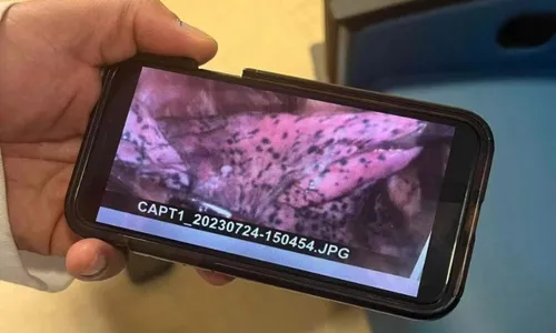 
          Imagem ilustrativa da imagem FOTO | Lutador de 20 anos posta foto do pulmão após uso de vape
          