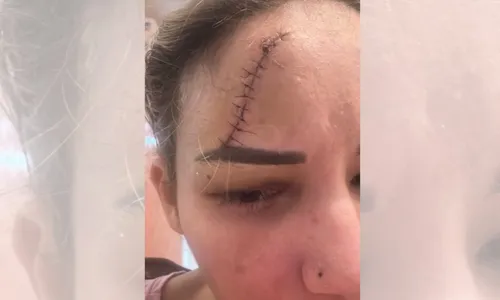 
          Imagem ilustrativa da imagem Foto mostra que médica já foi agredida por marido, afirma família
          