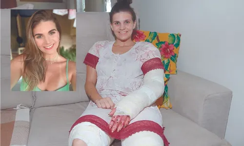 
          Imagem ilustrativa da imagem Influencer que teve o corpo queimado deixa hospital: “Deus que me deu forças”
          