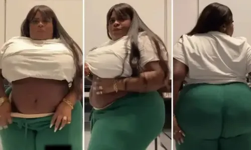 
          Imagem ilustrativa da imagem Jojo Todynho mostra como ficou sua barriga após cirurgia bariátrica
          