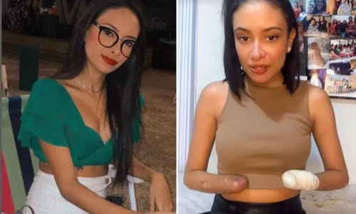 
          Imagem ilustrativa da imagem Jovem é internada com infecção urinária e tem pés e mãos amputados
          