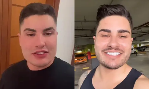 
          Imagem ilustrativa da imagem Lucas Souza, ex de Jojo Todynho, desfaz harmonização facial
          