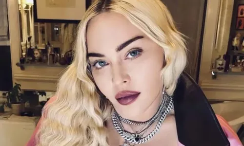 
          Imagem ilustrativa da imagem Madonna ensaiava 12 horas por dia antes de internação
          