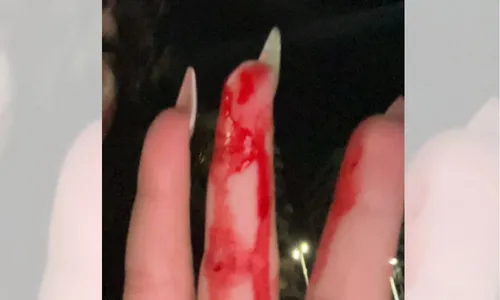 
          Imagem ilustrativa da imagem Moradores reclamam de pipas com cerol em Camburi
          