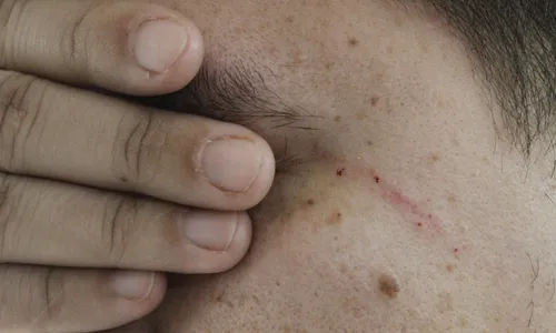 
          Imagem ilustrativa da imagem Mulher tenta roubar cigarro e agride dono de padaria com soco em Vitória
          