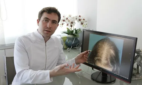 
          Imagem ilustrativa da imagem Mulheres fazem transplante para disfarçar queda dos fios
          