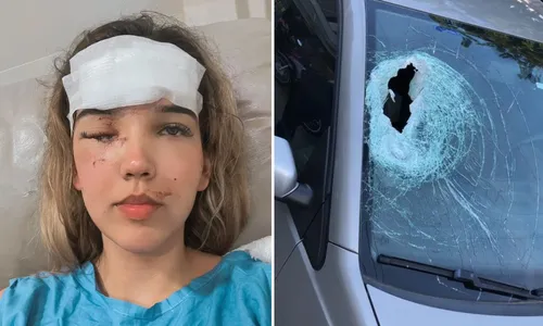 
          Imagem ilustrativa da imagem “Não desejo a ninguém”, diz advogada atingida por pedrada
          