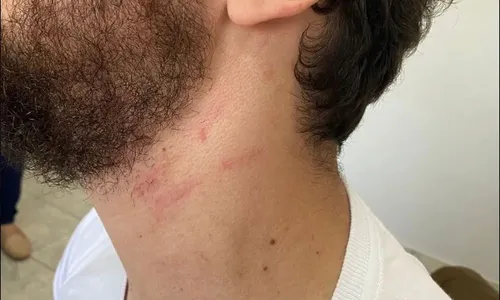 
          Imagem ilustrativa da imagem PF investiga delegado que agrediu professor do filho em escola
          