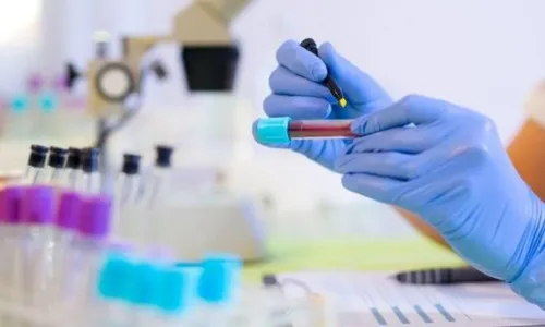 
          Imagem ilustrativa da imagem Pacientes buscam teste genético para identificar predisposição ao câncer
          