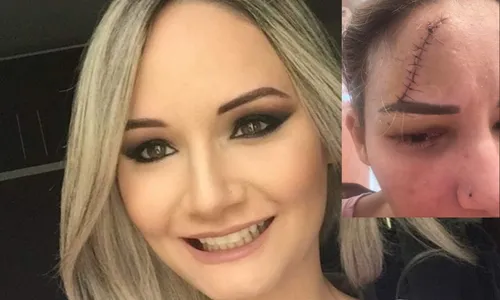 
          Imagem ilustrativa da imagem Pai da vítima: “Ela estava cheia de hematomas, machucada de chutes e pancadas”
          