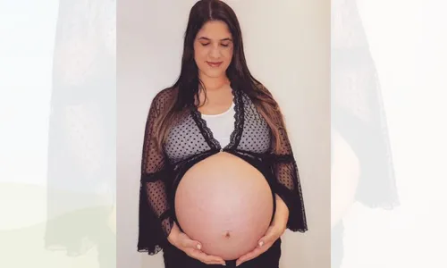 
          Imagem ilustrativa da imagem Parto dos sêxtuplos em Colatina terá operação com 23 profissionais
          