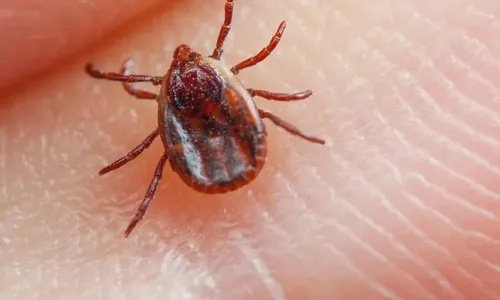 
          Imagem ilustrativa da imagem Saiba como se proteger contra a febre maculosa nas férias
          