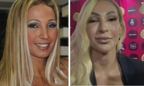 
          Imagem ilustrativa da imagem VÍDEO | Valesca Popozuda faz harmonização facial e choca com novo rosto
          