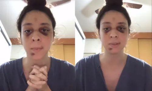 
          Imagem ilustrativa da imagem Victor Meyniel agradece apoio em vídeo após ter sofrido agressão
          