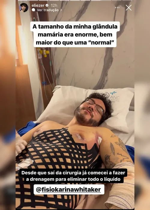 Imagem ilustrativa da imagem Veja o antes e depois das cirurgias plásticas do ex-BBB Eliezer