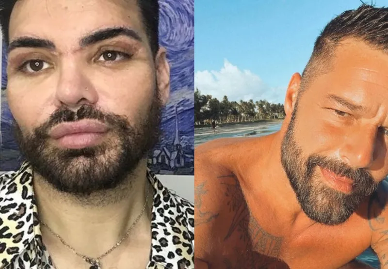 O desejo de se parecer mais com Ricky Martin surgiu após Francisco participar do reality show argentino Cuestion de Peso, onde perdeu 92 kg